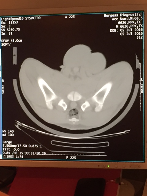 CT Image gigot